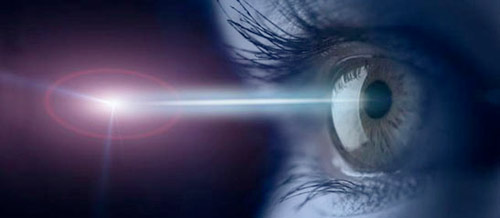 Vision